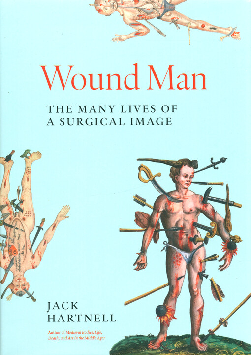 Wound man : the many lives of a surgical image