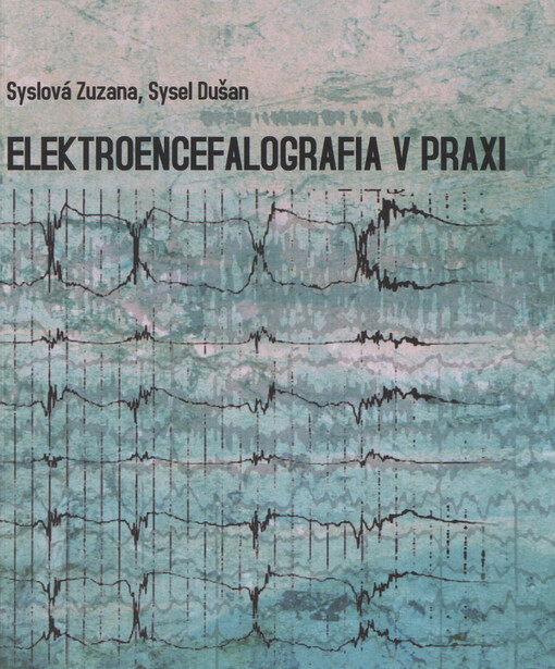 Elektroencefalografia v praxi