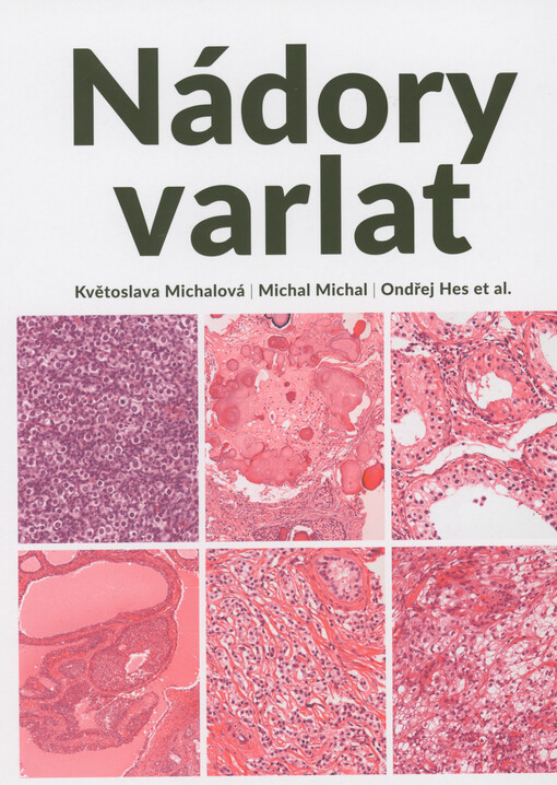 Nádory varlat