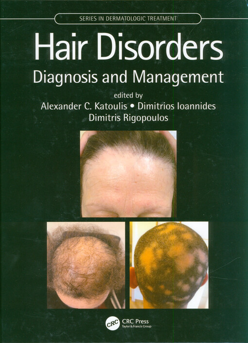 Hair disorders : diagnosis and management