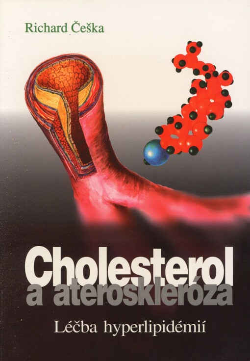 Cholesterol a ateroskleróza: léčba hyperlipidémií