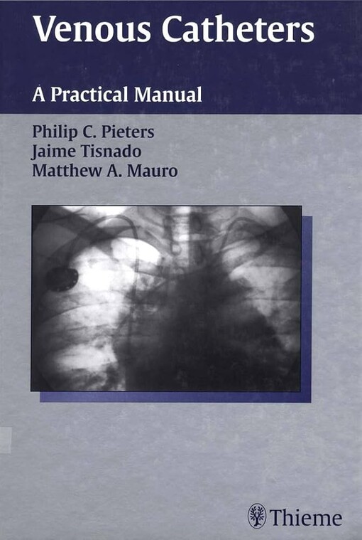 Venous Catheters: A Practical Manual