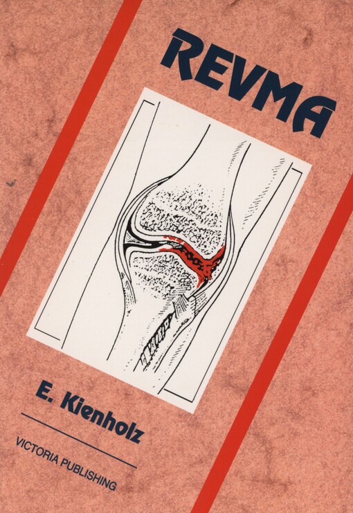 Revma: Odlišnosti klinického obrazu revmatických onemocnění : Způsoby léčby se zvláštním zřetelem na přírodní léčebné postupy a homeopatii