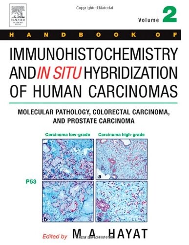 Handbook of immunohistochemistry and in situ hybridization of human carcinomas. Volume 2, Molecular pathology, colorectal carcinoma, and prostate carcinoma