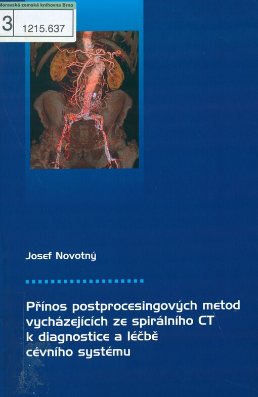 Přínos postprocesingových metod vycházejících ze spirálního CT k diagnostice a léčbě cévního systému