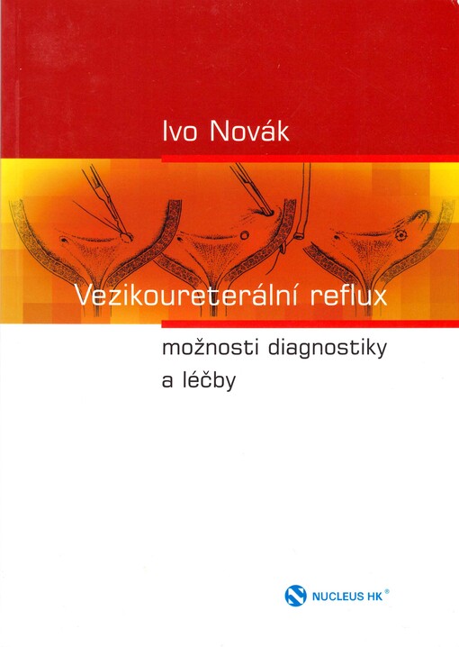 Vezikoureterální reflux : možnosti diagnostiky a léčby