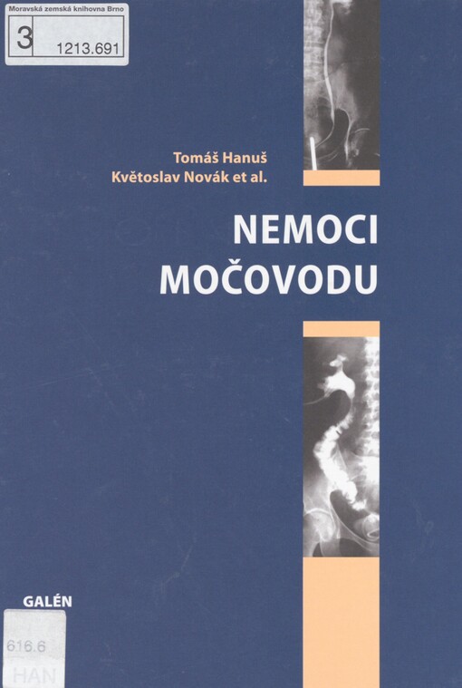 Nemoci močovodu