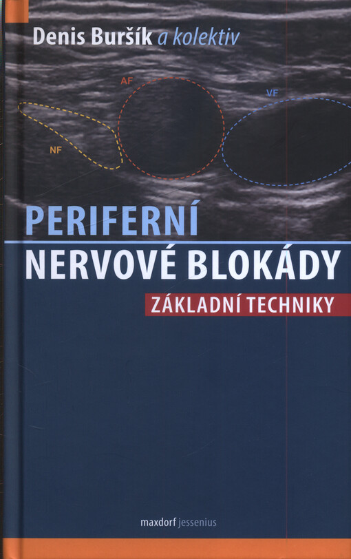 Periferní nervové blokády