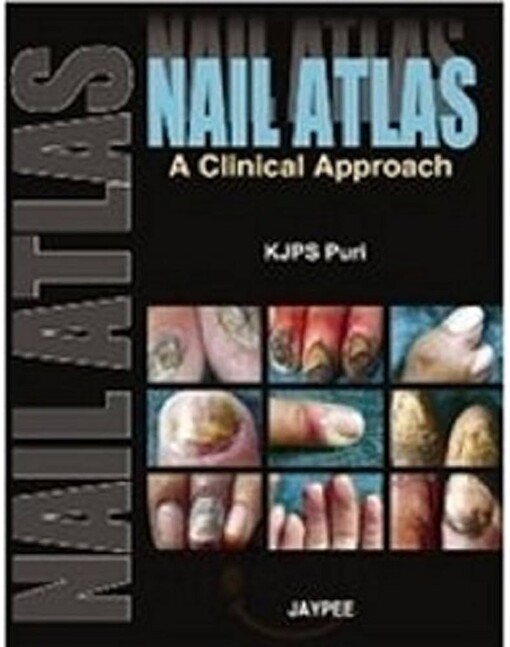 Nail atlas :a clinical approach