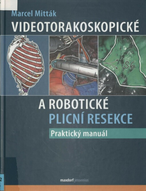 Videotorakoskopické a robotické plicní resekce