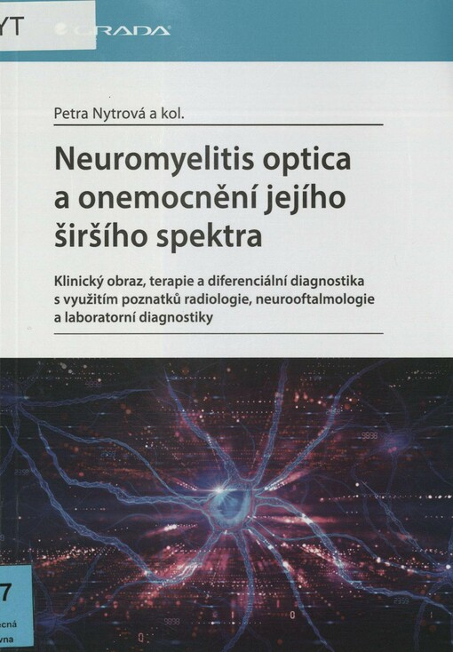 Neuromyelitis optica a onemocnění jejího širšího spektra: klinický obraz, terapie a diferenciální diagnostika s využitím poznatků radiologie, neurooftalmologie a laboratorní diagnostiky