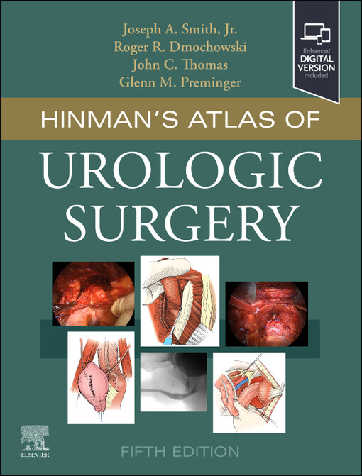 Hinman's atlas of urologic surgery