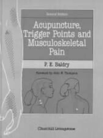 Acupuncture, Trigger Points and Musculoskeletal Pain: A Scientific Approach to Acupuncture