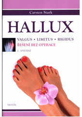 Hallux : valgus, limitus, rigidus : řešení bez operace  (odkaz v elektronickém katalogu)
