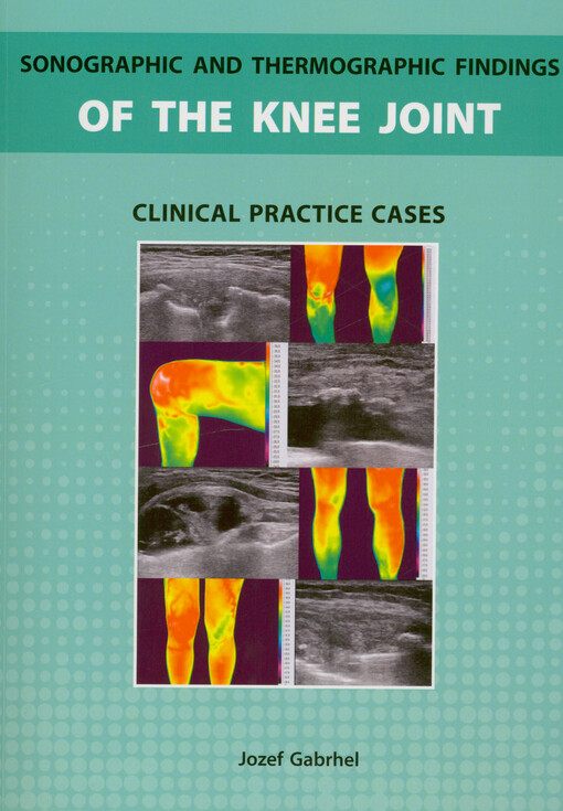 Sonographic and thermographic findings of the knee joint : clinical practice cases