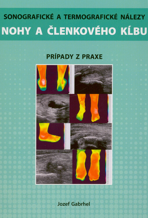 Sonografické a termografické nálezy nohy a členkového kĺbu : prípady z praxe