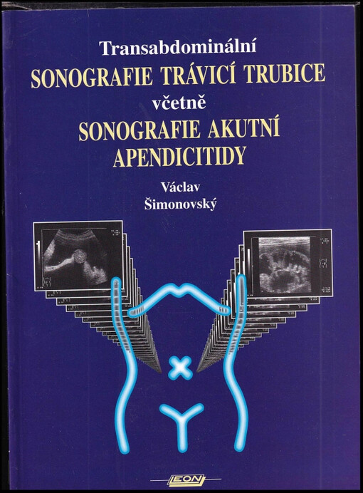 Transabdominální sonografie trávicí trubice včetně sonografie akutní apendicitidy