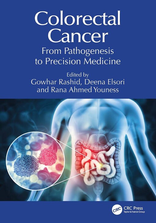 Colorectal cancer : from pathogenesis to precision medicine