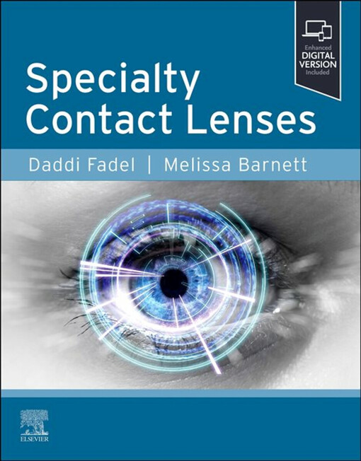 Specialty contact lenses
