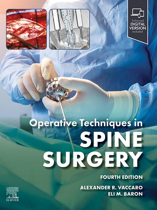 Operative techniques : spine surgery