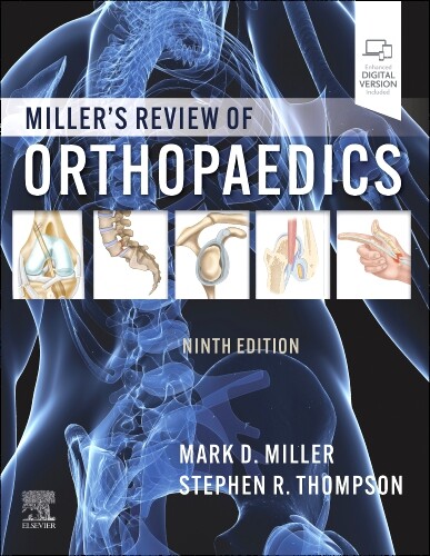 Miller's review of orthopaedics