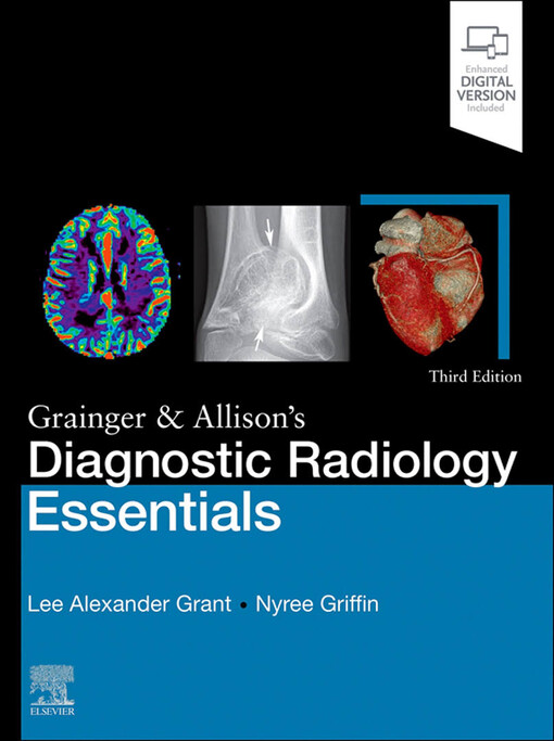 Grainger & Allison's diagnostic radiology essentials