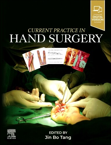 Current practice in hand surgery