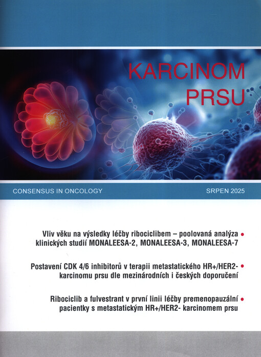 Karcinom prsu