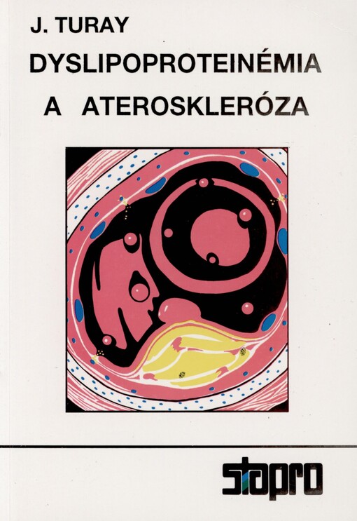 Dyslipoproteinémia a ateroskleróza