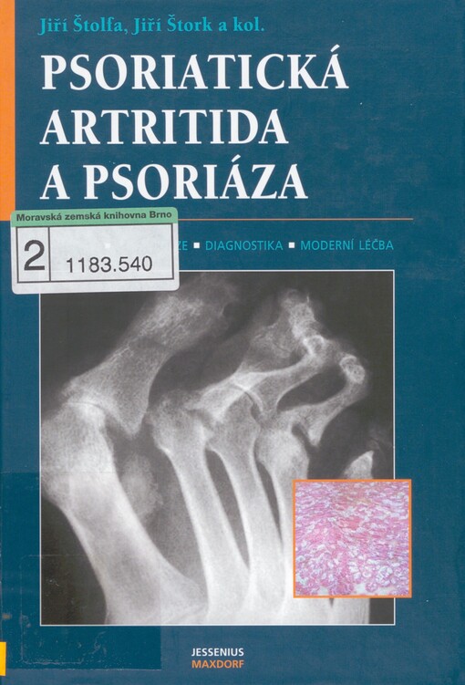 Psoriatická artritida a psoriáza: [etiologie, patogeneze, diagnostika, moderní léčba]