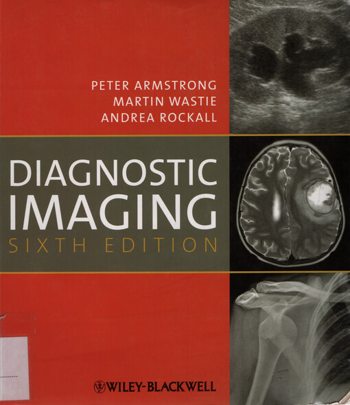 Diagnostic imaging