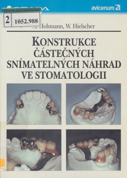 Konstrukce částečných snímatelných náhrad ve stomatologii