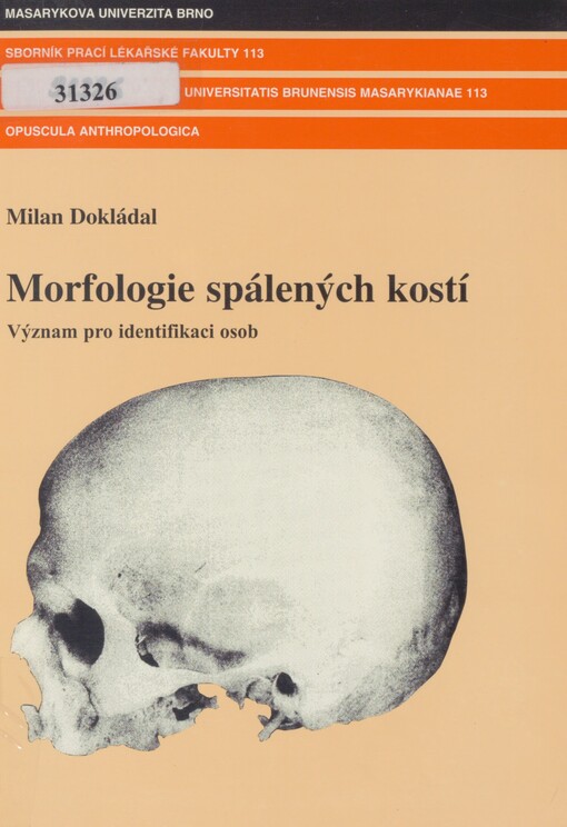 Morfologie spálených kostí: význam pro identifikaci osob