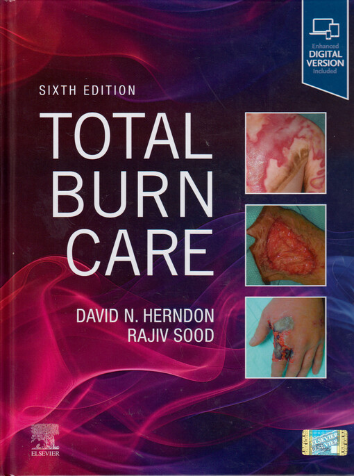 Total burn care