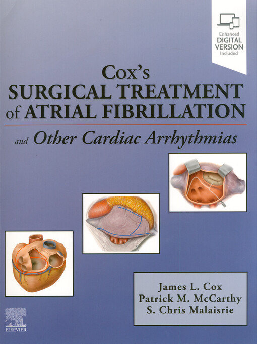 Cox's surgical treatment of atrial fibrillation and other cardiac arrhythmias