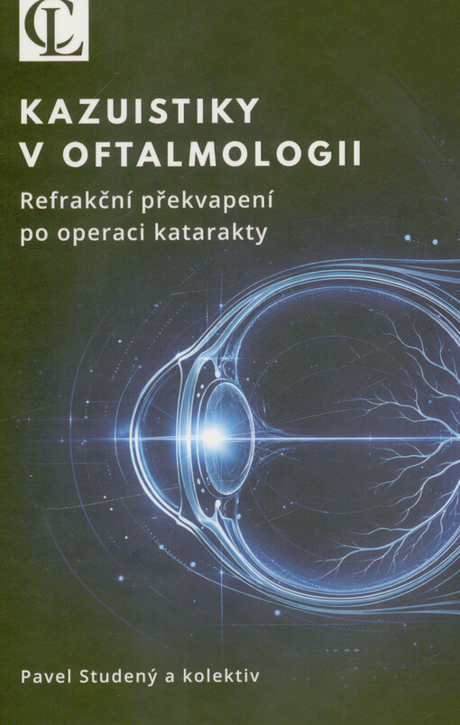 Kazuistiky v oftalmologii : refrakční překvapení po operaci katarakty