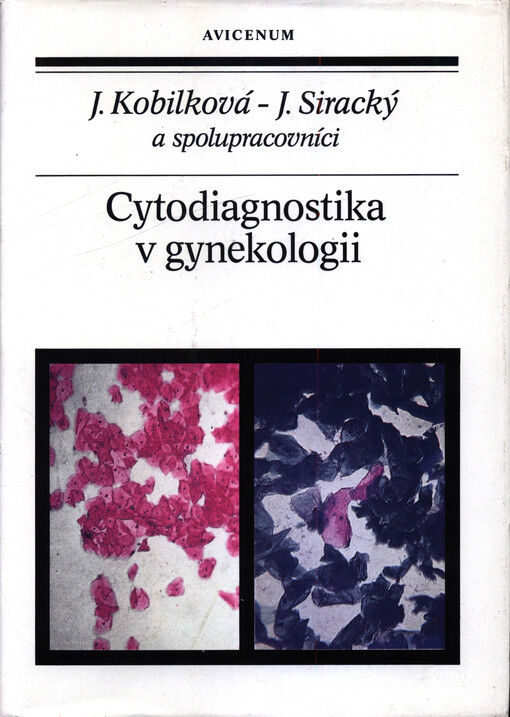 Cytodiagnostika v gynekologii