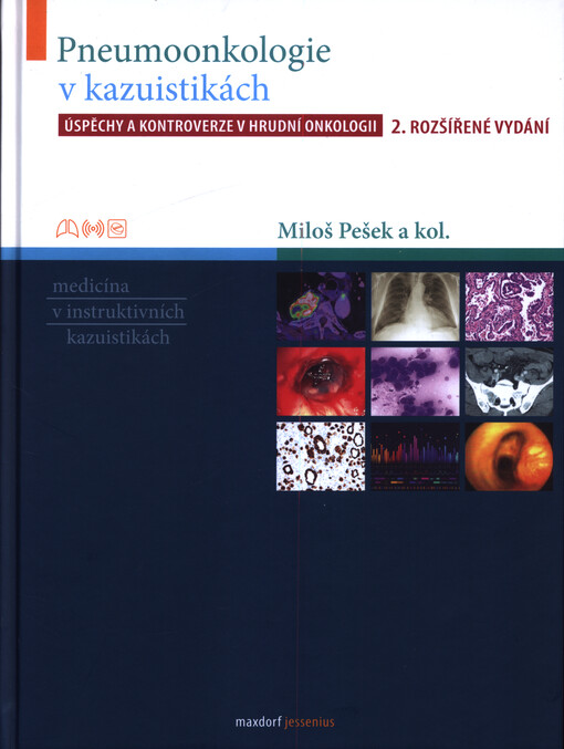 Pneumoonkologie v kazuistikách