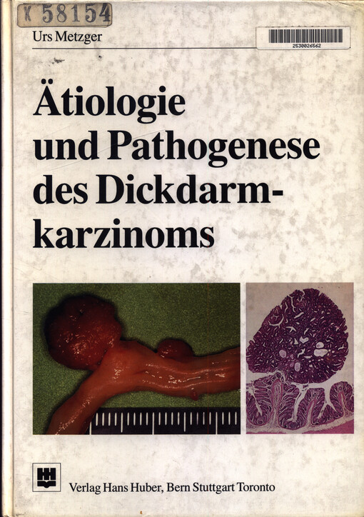 Ätiologie und Pathogenese des Dickdarmkarzinoms