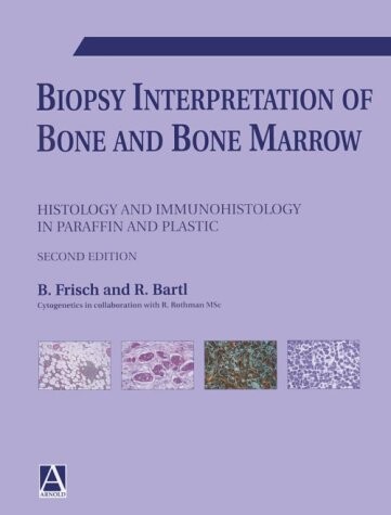 Biopsy Interpretation of Bone and Bone Marrow (Hodder Arnold Publication)