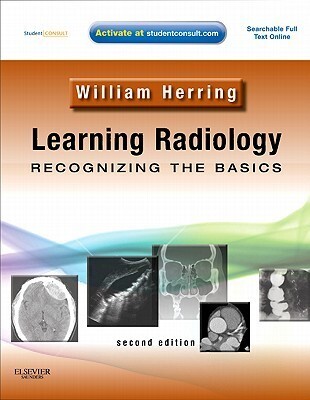 Learning radiology :recognizing the basics
