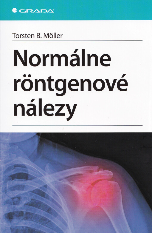 Normálne röntgenové nálezy