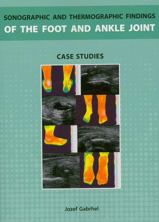 Sonographic and thermographic findings of the foot and ankle joint : case studies