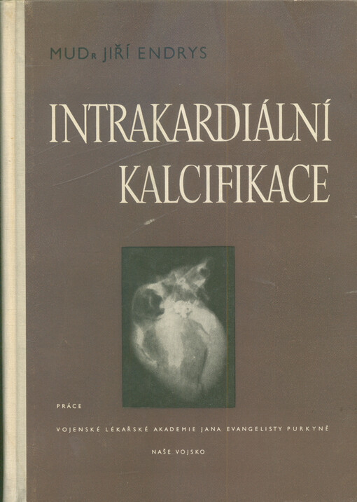 Intrakardiální kalcifikace : (patogenesa, diagnostika a klinický význam)