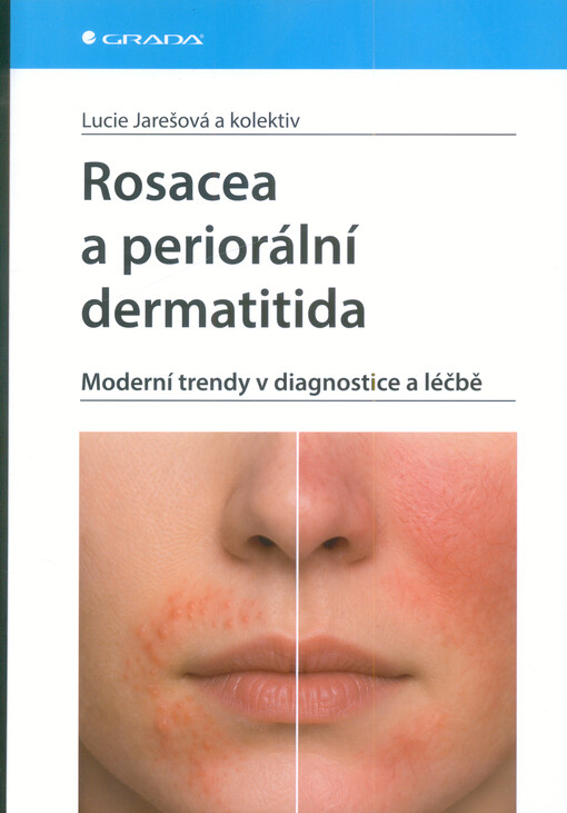 Rosacea a  periorální dermatitida