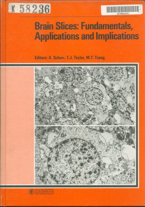 Brain slices : fundamentals, applications and implications : conference, Louisville : June 4-6, 1986