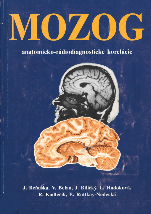 Mozog : anatomicko-rádiodiagnostické korelácie