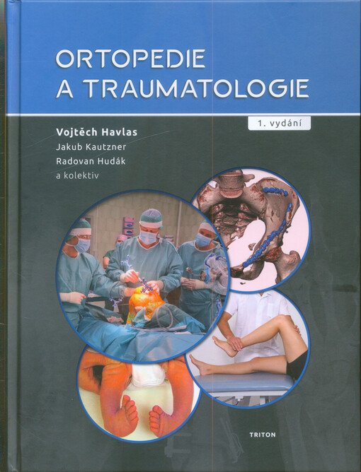 Ortopedie a traumatologie