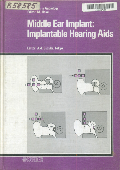 Middle ear implant : implantable hearing aids