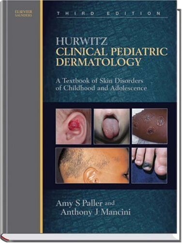Hurwitz clinical pediatric dermatology : a textbook of skin disorders of childhood and adolescence